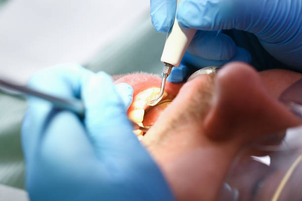 Best Urgent Dental Care for Toothaches in Advae, NC